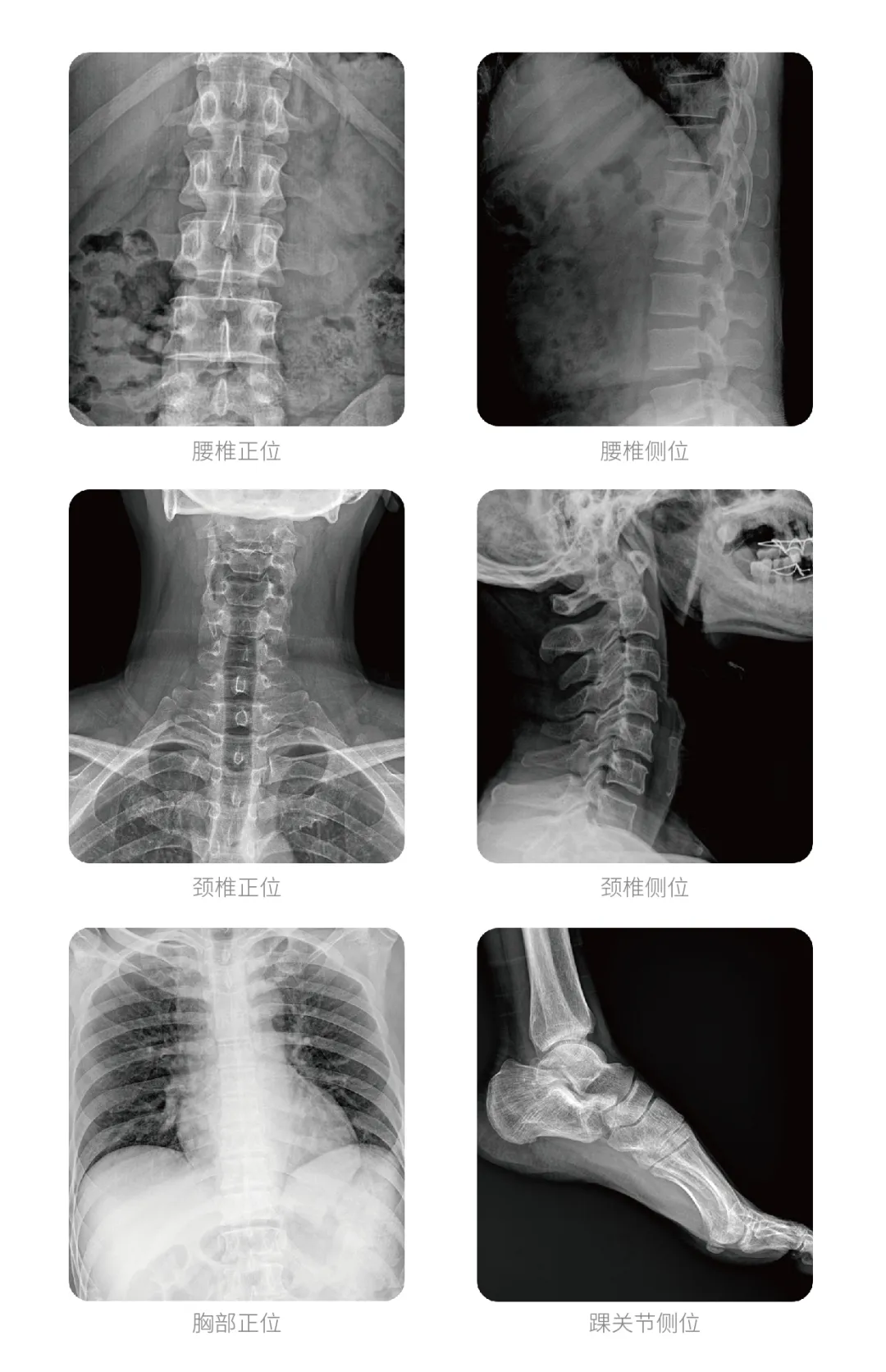 移动DR有哪些临床应用