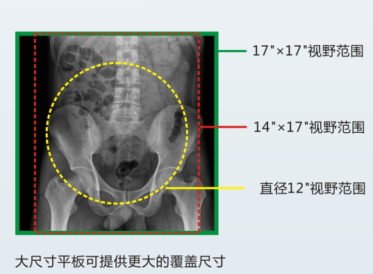 数字胃肠机