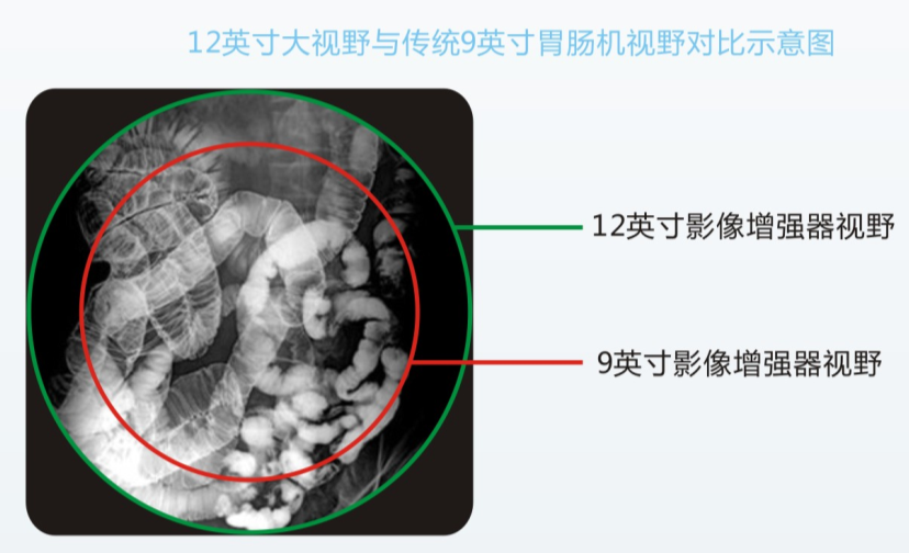 數字胃腸機