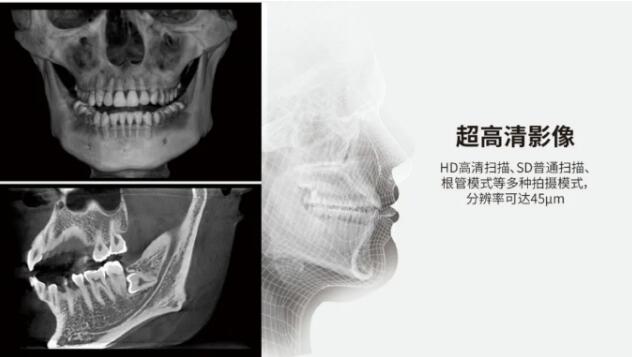 口腔锥形束CT