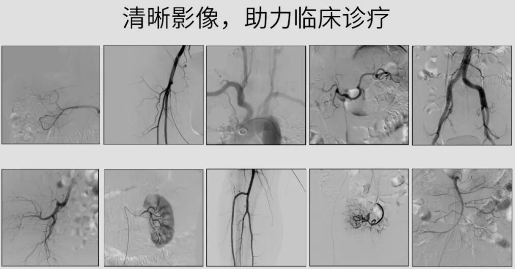 介入动态C臂图像