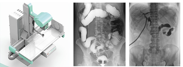 数字X线摄影DR影像