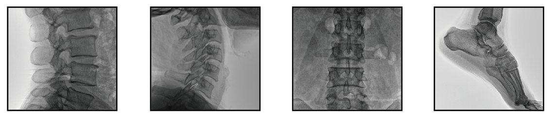 透视C形臂X光机影像