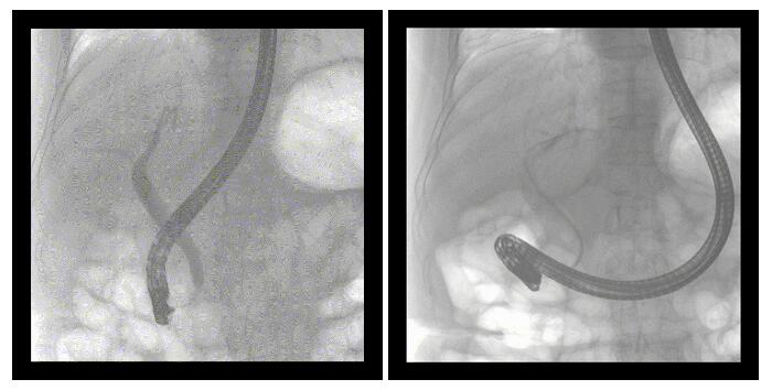 移动式平板中C术中影像