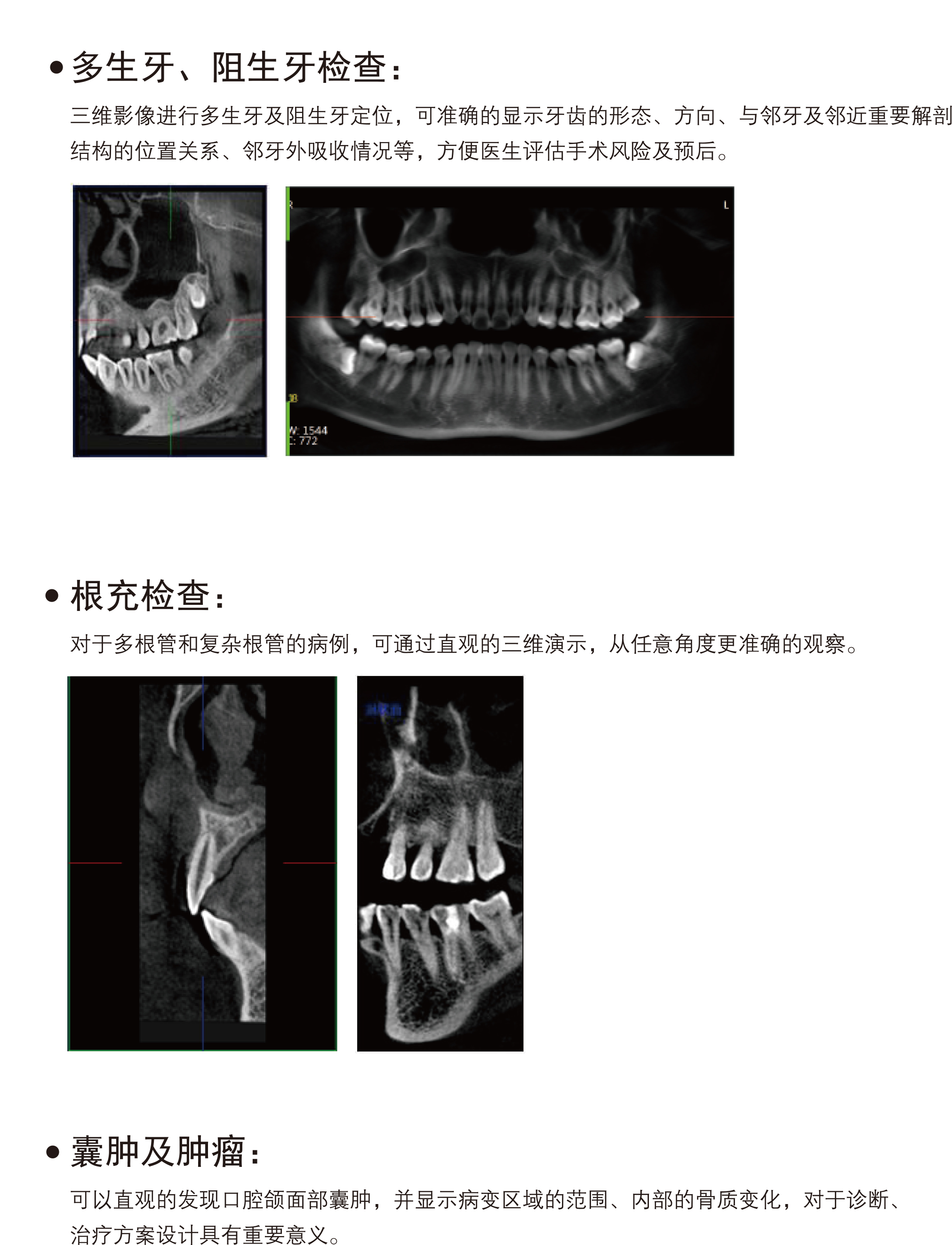 牙科CBCT-PLX3000A